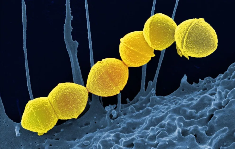 La causa principal del STSS es una bacteria a menudo denominada estreptococo A. Foto: Wionews.com