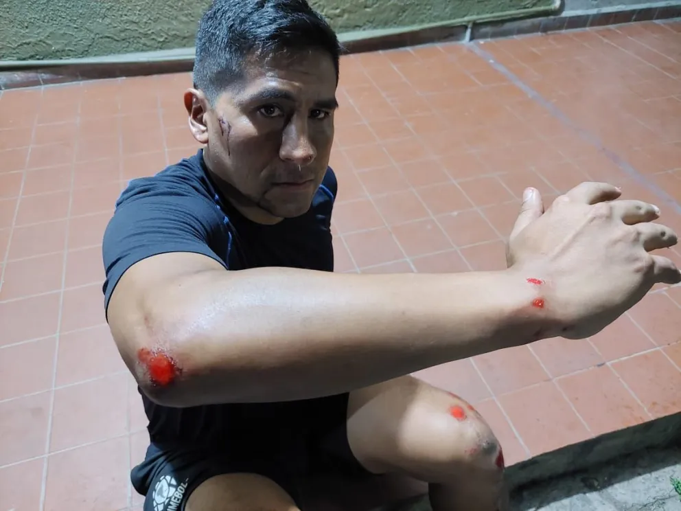 William Medina muestra los efectos de la agresión que sufrió este sábado. Foto: ABAF