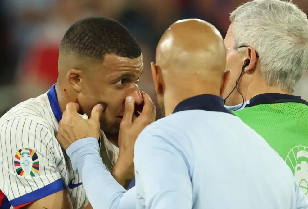 Mbappé se toca su nariz tras sufrir el fuerte golpe en el partido. Foto EFE