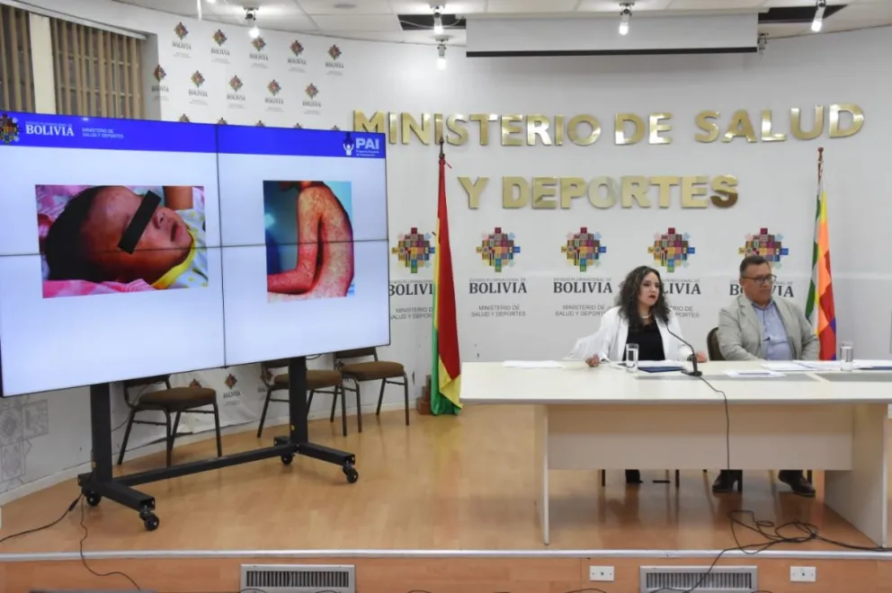 La ministra de Salud, María Renée Castro, brinda este miércoles una conferencia de prensa. Foto: APG