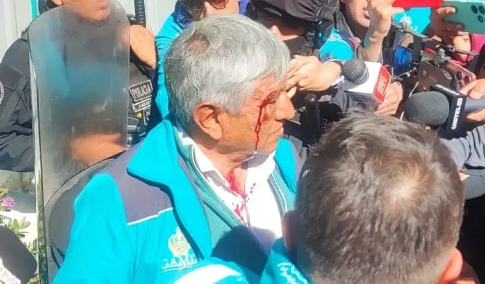 El acalde Arias tras ser agredido en la plaza Abaroa. Foto: Alcaldía de La Paz