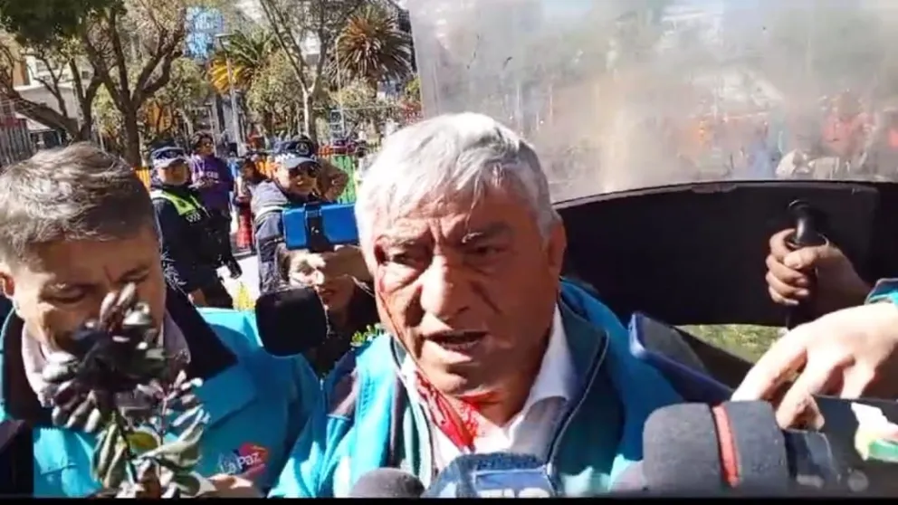 El alcalde Arias tras la agresión que sufrió hoy. Foto: Alcaldía de La Paz