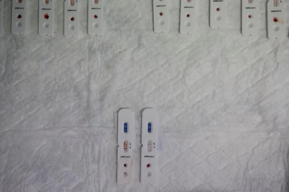 Varios test rápidos utilizados para saber si una persona ha generado anticuerpos del Covid-19. Fotos: EFE
