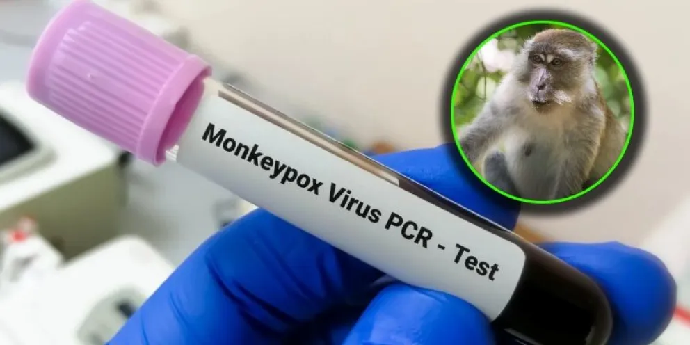 Foto referencial (OPS)