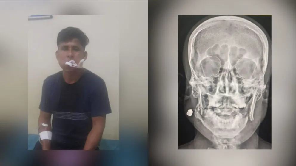 Marcos Divvapuri, uno de los heridos. Foto: Dayana Duran en Facebook