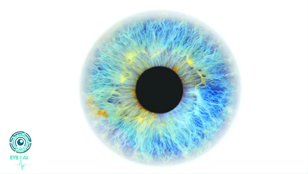 Iris y pupila humana ampliados mediante una fotografía. FOTO: Equipo EYE_AI