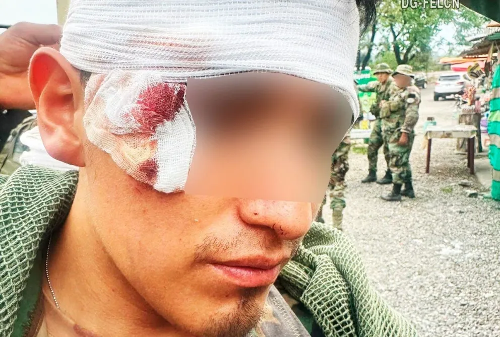 Uno de los efectivos afectados por emboscada en el Chapare, según la Felcn. Foto: Felcn