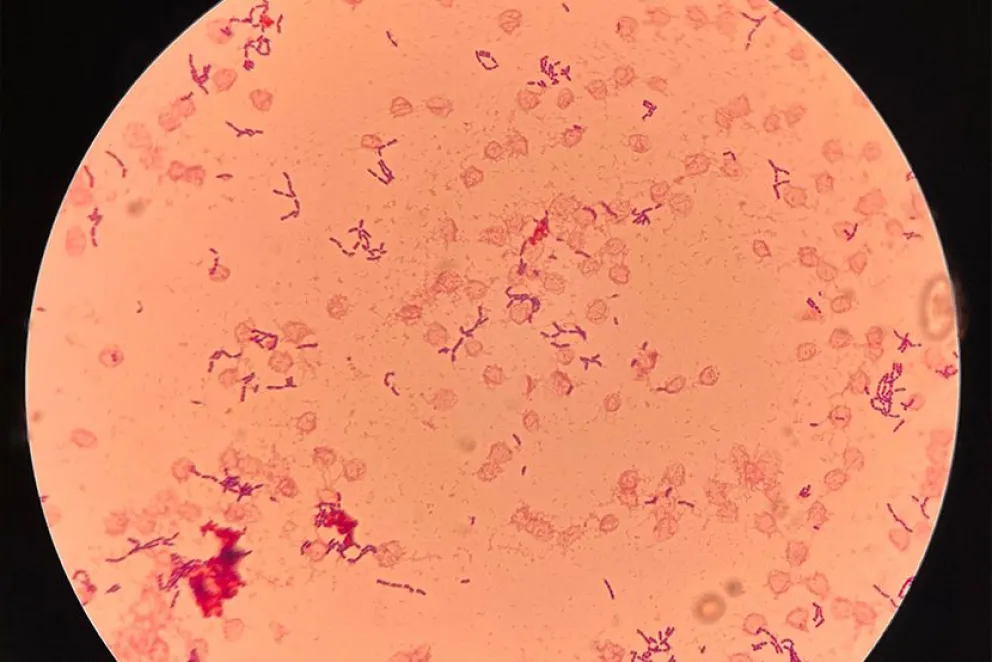 Toma de microscopio de la bacteria Streptococcus Pyogenes. FOTO: Sociedad Chilena de Infectología