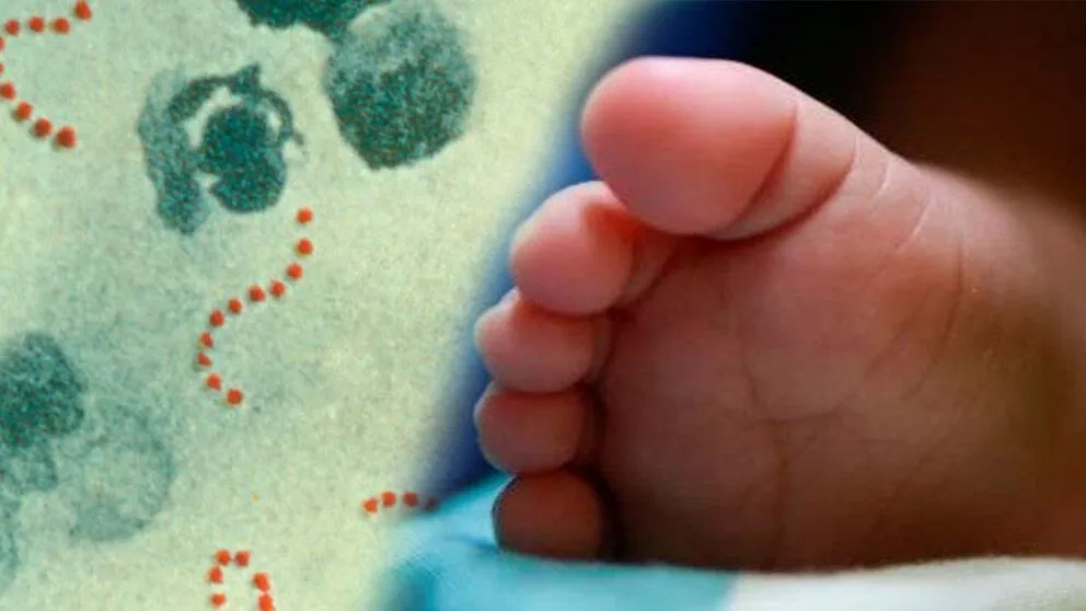 Imagen referencial sobre el ataque de bacterias a niños. Composición: Opinión 
