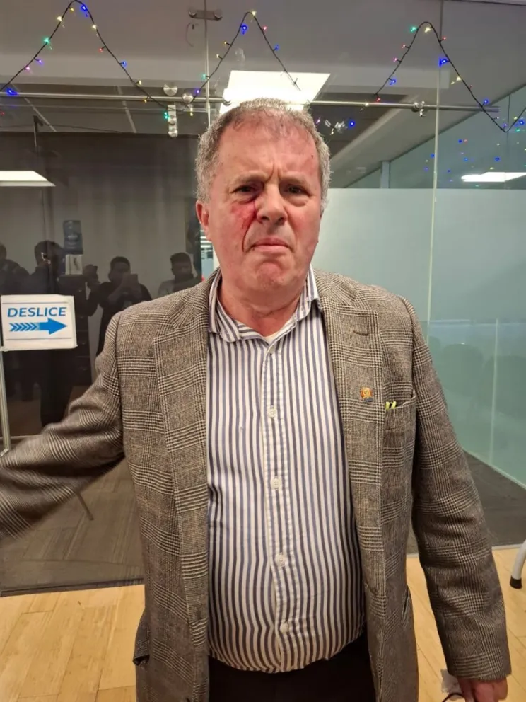 El diputado de la opositora Comunidad Ciudadana (CC), Miguel Roca. Foto: DTV