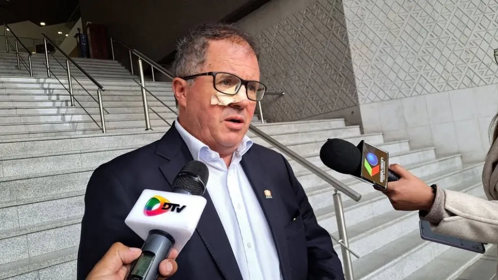 El diputado Miguel Roca fue agredido en la cara. Foto: DTV