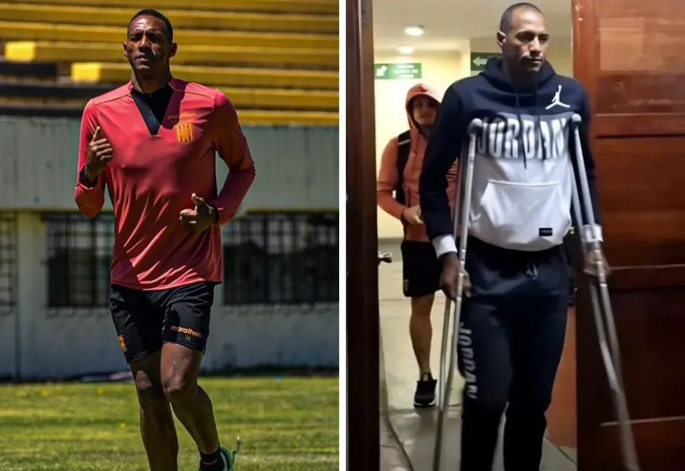 El panameño Abdiel Ayarza cuando llegó a La Paz en julio y después de su lesión en noviembre.