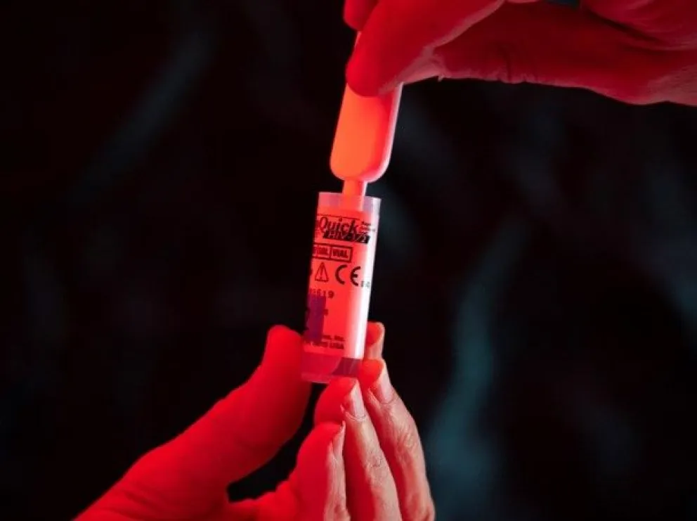 En la imagen de archivo, una persona se realiza una prueba rápida, anónima y gratuita de VIH. Foto: EFE