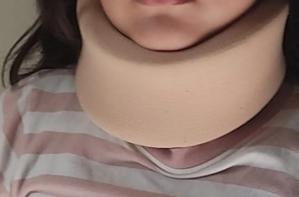 Imagen referencial de una menor con un collar cervical. Foto: RRSS