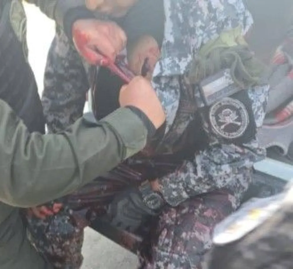 Un policía herido por arma de fuego en la localidad de Llallagua. Foto: Captura