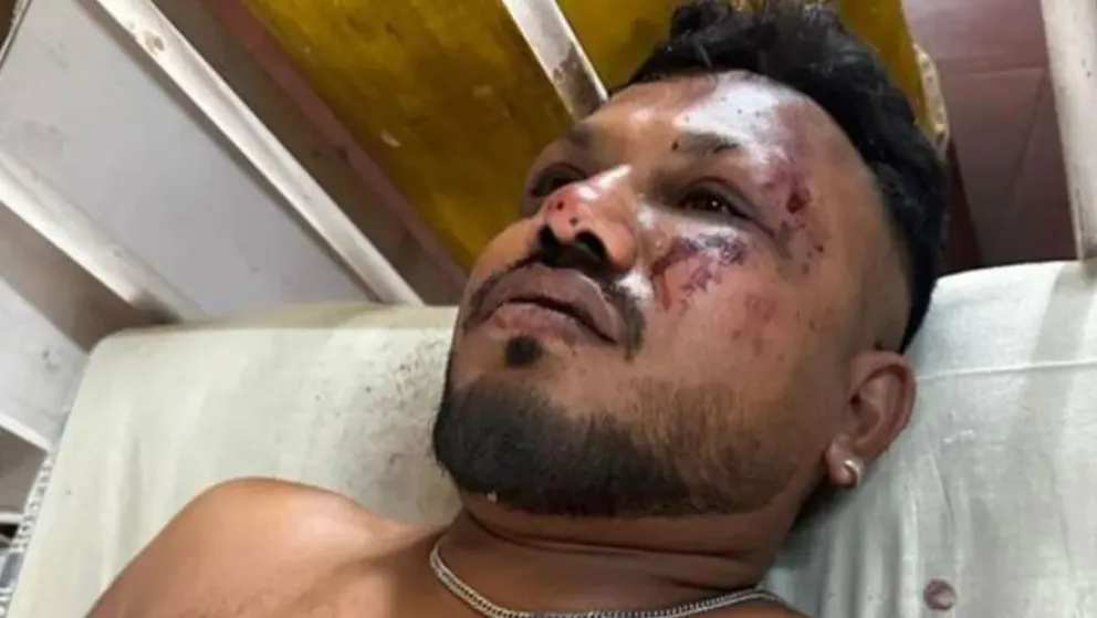 Vishwash Kumar Ramesh, reportado por los medios locales como un sobreviviente del accidente del vuelo 171 de Air India. Foto: Hindustan Times