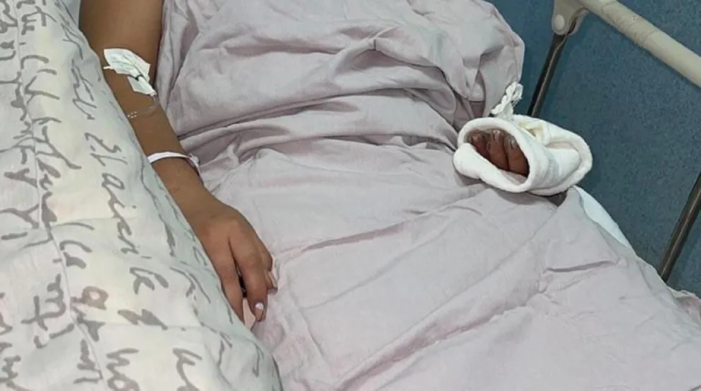 Algunas de las heridas de la víctima. FOTO: Fiscalía Departamental de Cochabamba