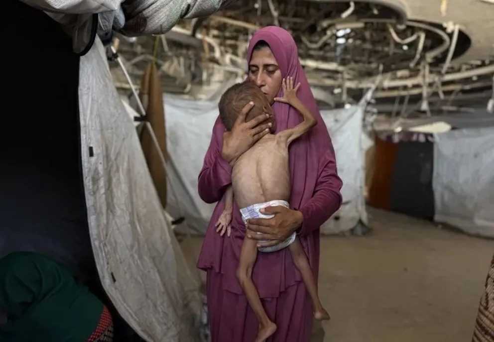 Un niño gazatí de 18 meses, de cuerpo esquelético, en brazos de su madre en una imagen del 26 de julio de 2025. Foto: EFE