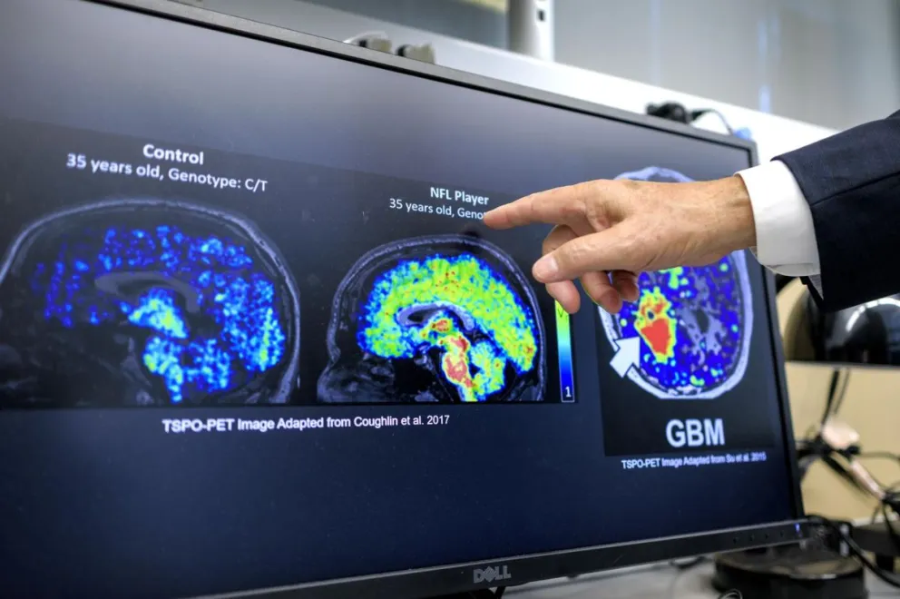 Imágenes de autorradiografía cuantitativa mostradas en una pantalla, en el laboratorio de la Universidad Internacional de Florida, en Miami (EEUU). Foto: EFE