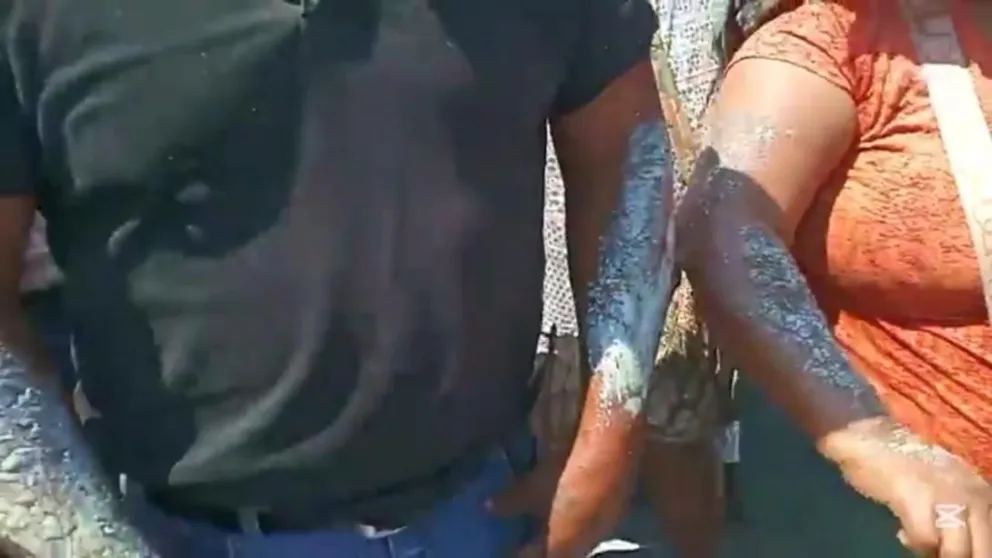 Una de las víctimas del incendio, con quemaduras. Foto: RRSS