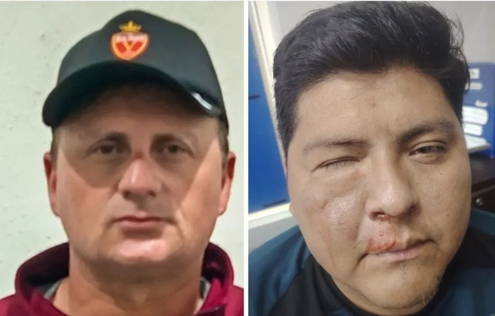 Robledo (izq.) y Méndez quedaron malheridos tras la trifulca en Oruro. Fotos: Real Oruro y Club Blooming.