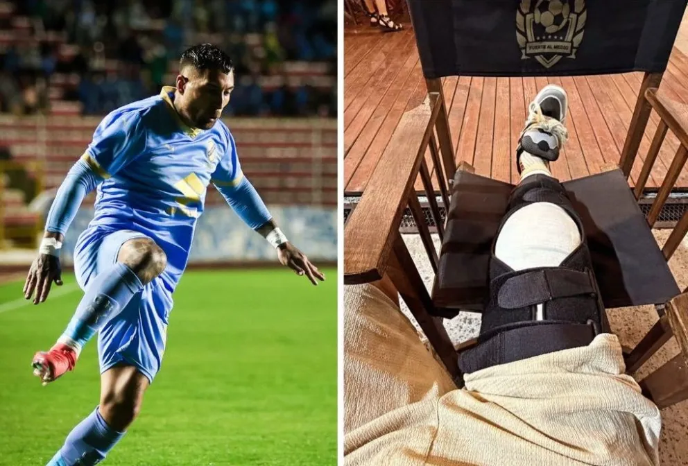 Batallini (izq.) en un partido con la Academia. A lado, su rodilla tras la operación. Fotos: Club Bolívar y Damián Batallini.