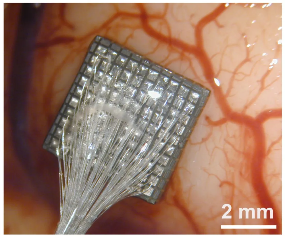 Electrodo cerebro: Imagen de una matriz de 100 microelectrodos en corteza cerebral humana. Cedida por el Instituto de Bioingeniería de la Universidad Miguel Hernández de Elche.