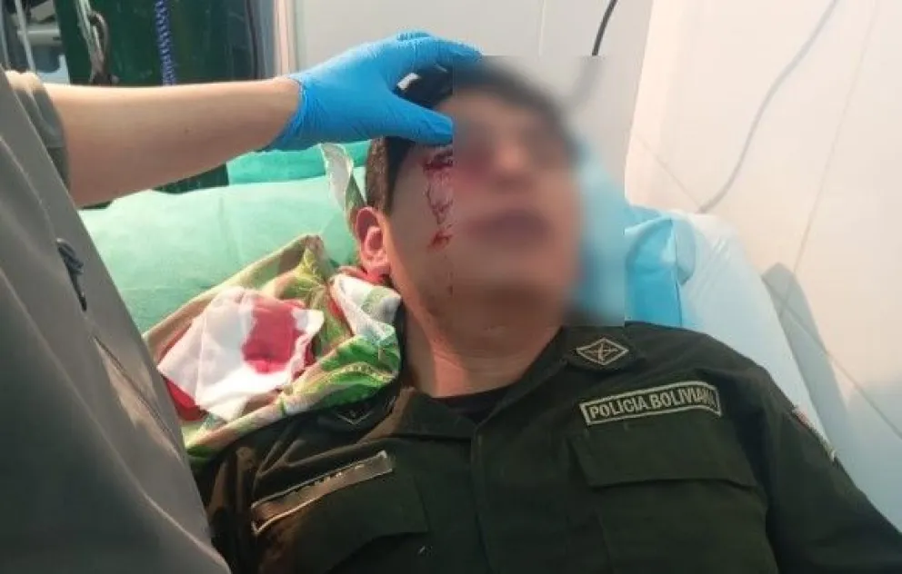 Uno de los policías heridos en el Ministerio de Educación. Foto: Ministerio de Educación